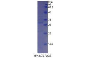 SDS-PAGE (SDS) image for Tyrosinase (TYR) (AA 5-245) protein (His tag) (ABIN1878881)