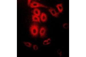 Immunofluorescent analysis of Telethonin staining in Hela cells.