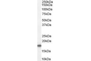 ABIN185573 (1µg/ml) staining of Human Testis Lysate (35µg protein in RIPA buffer). (Stathmin 1 Antikörper  (C-Term))