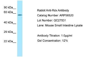 Western Blotting (WB) image for anti-Radixin (RDX) (C-Term) antibody (ABIN2786751) (Radixin Antikörper  (C-Term))