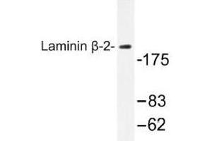 Image no. 1 for anti-Laminin, beta 2 (Laminin S) (LAMB2) antibody (ABIN317724)