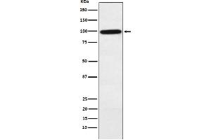 Western blot analysis of Complement factor B expression in Human plasma lysate.