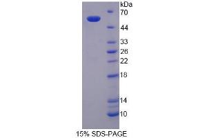 SDS-PAGE analysis of Mouse SPTLC3 Protein. (SPTLC3 Protein)
