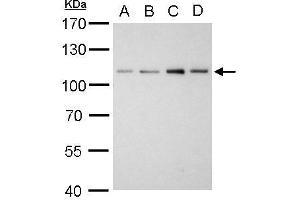 WB Image Alpha Actinin 2 antibody [N1N3] detects ACTN2 protein by western blot analysis.