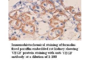 Immunohistochemistry (IHC) image for anti-Vascular Endothelial Growth Factor A (VEGFA) antibody (ABIN6583751) (VEGFA Antikörper)