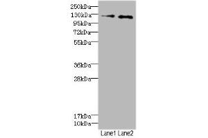 Western blot All lanes: HEPH antibody at 2. (Hephaestin Antikörper  (AA 300-580))