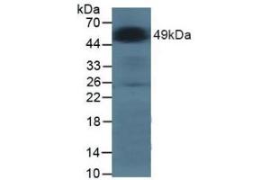 Figure. (GLA Antikörper  (AA 81-429))