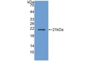 Figure. (UBE2L3 Antikörper  (AA 4-154))
