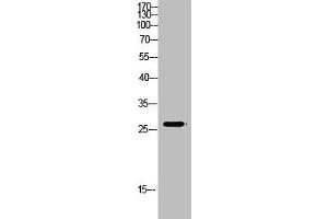 Western Blot analysis of mouse-kidney cells using Antibody diluted at 500. (MBL2 Antikörper  (AA 21-70))