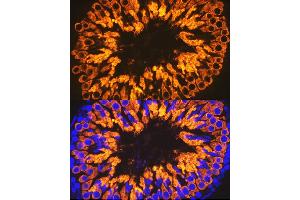 Immunofluorescence (IF) image for anti-Calmegin (CLGN) antibody (ABIN7266025)