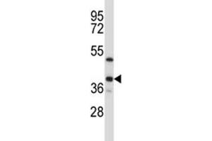 ERCC1 antibody western blot analysis in T47D lysate (ERCC1 Antikörper  (AA 268-297))