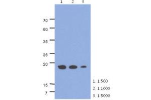 The cell lysates of HepG2 (40ug) were resolved by SDS-PAGE, transferred to PVDF membrane and probed with anti-human ADI1 antibody (1:500 ~ 1:1000). (ADI1 Antikörper)