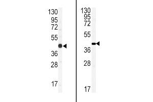 (LEFT)Western blot analysis of anti-GJA1 Antibody (N-term) in CEM cell line lysates (35ug/lane).