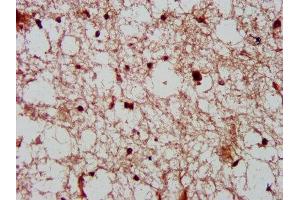 IHC image of ABIN7148847 diluted at 1:600 and staining in paraffin-embedded human brain tissue performed on a Leica BondTM system. (Cyclin-Dependent Kinase 11A (CDK11A) (AA 5-216) Antikörper)