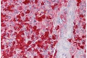 Spleen stained in Immunohistochemistry on Paraffin Sections with S100A9 antibody (S100A9 Antikörper  (C-Term))
