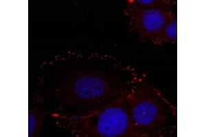 Immunofluorescence staining of methanol-fixed Hela cells using FAK(phospho-Tyr576/Tyr577) Antibody. (FAK Antikörper  (pTyr576, pTyr577))