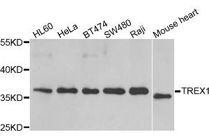 Western blot analysis of extracts of various cell lines, using TREX1 antibody (ABIN5974106) at 1/1000 dilution. (TREX1 Antikörper)