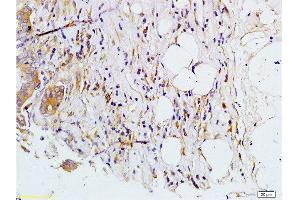 Immunohistochemistry (Paraffin-embedded Sections) (IHC (p)) image for anti-Matrix Metallopeptidase 7 (Matrilysin, Uterine) (MMP7) (AA 151-250) antibody (ABIN668451)