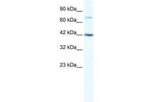 Western Blotting (WB) image for anti-GLI Family Zinc Finger Protein 4 (GLI4) antibody (ABIN2461601) (GLI4 Antikörper)