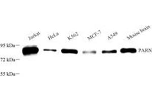 Western blot analysis of PARN (ABIN7075117),at dilution of 1: 1000 (PARN Antikörper)