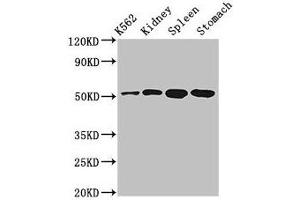 Western Blot Positive WB detected in: K562 whole cell lysate, Rat kidney tissue, Rat spleen tissue, Mouse stomach tissue All lanes: ALDH3B1 antibody at 3 μg/mL Secondary Goat polyclonal to rabbit IgG at 1/50000 dilution Predicted band size: 52, 48 kDa Observed band size: 52 kDa (ALDH3B1 Antikörper  (AA 168-449))