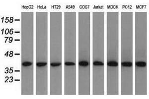 Image no. 8 for anti-Acetyl-CoA Acetyltransferase 2 (ACAT2) antibody (ABIN1496400) (ACAT2 Antikörper)