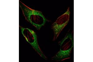 Fluorescent image of Hela cell stained with DDIT3 Antibody (C-term ) (ABIN655895 and ABIN2845295)/SA101207.