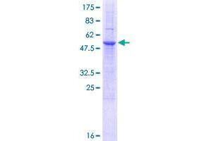Image no. 1 for Retinoic Acid Early Transcript 1E (RAET1E) (AA 1-263) protein (GST tag) (ABIN1317306)