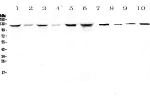 Western blot analysis of IDE using anti-IDE antibody .