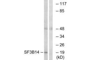 Western blot analysis of extracts from HepG2 cells, using SF3B14 antibody. (Pre-mRNA Branch Site Protein p14 (SF3B14) (C-Term) Antikörper)