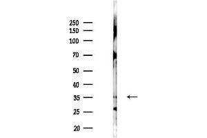 Western blot analysis of lysates from PC12 cells(LPS 4h treatment), using KLHDC8A Antibody at 1/1000 dilution.
