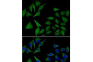Immunofluorescence analysis of MCF7 cells using ATOX1 Polyclonal Antibody (ATOX1 Antikörper)