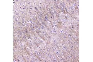 IHC testing of FFPE rat brain tissue with LC3A antibody at 1ug/ml. (MAP1LC3A Antikörper)