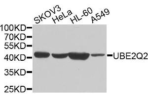 Western blot analysis of extracts of various cells, using UBE2Q2 antibody. (UBE2Q2 Antikörper)
