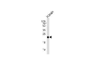 Western blot analysis of lysate from human brain tissue lysate, using CPLX3 Antibody (Center) (ABIN654609 and ABIN2844309). (CPLX3 Antikörper  (AA 52-81))