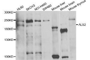 Western blot analysis of extracts of various cell lines, using ALS2 antibody.