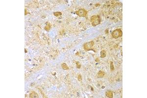 Immunohistochemistry of paraffin-embedded mouse brain using SPAG16 antibody at dilution of 1:100 (x400 lens). (SPAG16 Antikörper)