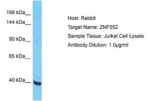 Host: Rabbit Target Name: ZNF552 Sample Type: Jurkat Whole Cell lysates Antibody Dilution: 1. (ZNF552 Antikörper  (Middle Region))