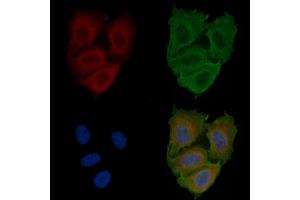 ABIN6260215 and ABIN6266858 staining Hela cells(24h of starvation treatment) by IF/ICC.