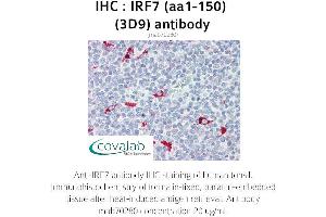Image no. 1 for anti-Interferon Regulatory Factor 7 (IRF7) (AA 1-150) antibody (ABIN1723206) (IRF7 Antikörper  (AA 1-150))