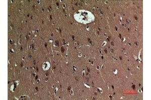 Immunohistochemistry (IHC) analysis of paraffin-embedded Human Brain, antibody was diluted at 1:100. (BNIP3 Antikörper  (Internal Region))