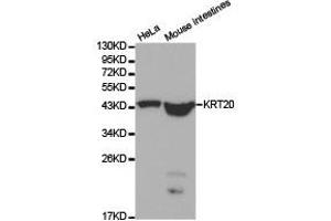 Western Blotting (WB) image for anti-Keratin 20 (KRT20) antibody (ABIN1873482) (KRT20 Antikörper)