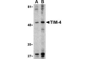 Western blot analysis of TIM-4 in Jurkat lysate with TIM-4 antibody at (A) 1 and (B) 2 μg/ml. (TIMD4 Antikörper  (Center))