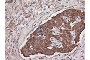 Immunohistochemical staining of paraffin-embedded kidney using anti-CPA1 (ABIN2452647) mouse monoclonal antibody. (CPA1 Antikörper  (AA 1-419))