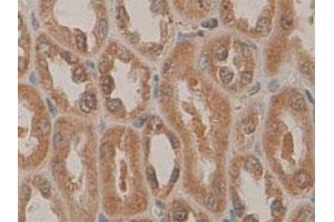 Immunohistochemical staining of formalin-fixed paraffin-embedded human fetal kidney tissue showing cytoplasmic and nuclear staining with PDCD5 polyclonal antibody  at 1 : 100 dilution. (PDCD5 Antikörper  (N-Term))