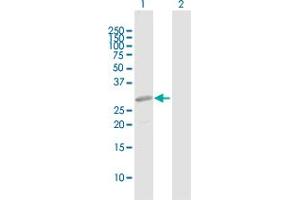 Western Blot analysis of PRRX2 expression in transfected 293T cell line by PRRX2 MaxPab polyclonal antibody. (PRRX2 Antikörper  (AA 1-253))