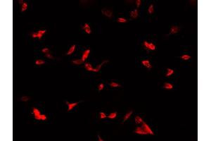 ABIN6269013 staining MCF-7 cells by IF/ICC. (COX IV Antikörper  (Internal Region))
