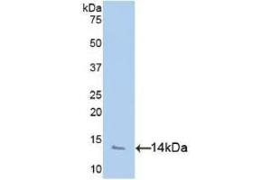 WB of Protein Standard: different control antibodies against Highly purified E. (PF4 CLIA Kit)
