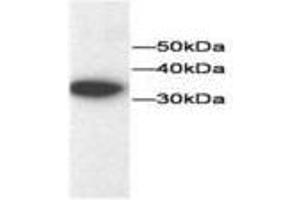 Image no. 1 for anti-Thioredoxin (TXN) antibody (ABIN791544) (TXN Antikörper)