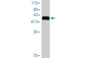Western Blot detection against Immunogen (56. (ZNF277 Antikörper  (AA 1-278))
